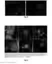 Fig. 03 - Method for removing undifferentiated and dedifferentiated stem cell