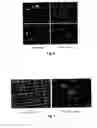 Fig. 04 - Method for removing undifferentiated and dedifferentiated stem cell