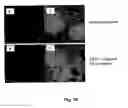 Fig. 09 - Method for removing undifferentiated and dedifferentiated stem cell