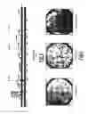 Fig. 04 - Dengue serotype 1 attenuated strain