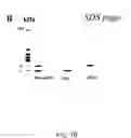 Fig. 03 - Nucleic acids encoding biologically active polypeptides derived from a novel early stage pregnancy factor designated maternin (MA)