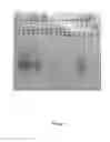 Fig. 06 - Synthesis of long-chain polyunsaturated fatty acids by recombinant cells