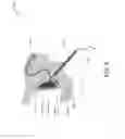 Fig. 03 - GUIDED PROCEDURAL TREATMENT DEVICE AND METHOD