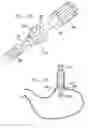 Fig. 22 - Remote tissue retraction device