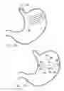 Fig. 40 - Remote tissue retraction device