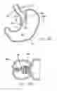 Fig. 44 - Remote tissue retraction device