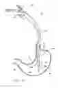 Fig. 45 - Remote tissue retraction device