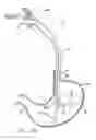 Fig. 46 - Remote tissue retraction device