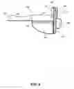 Fig. 07 - Minimally obstructive retractor