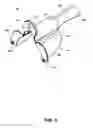Fig. 09 - Minimally obstructive retractor