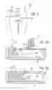 Fig. 02 - Foam Surgical Retractor