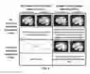 Fig. 02 - HEAD INJURY DIAGNOSTICS