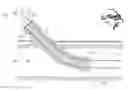 Fig. 01 - LIGHT-GUIDED TRANSLUMINAL CATHETER