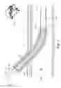 Fig. 02 - LIGHT-GUIDED TRANSLUMINAL CATHETER