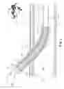 Fig. 03 - LIGHT-GUIDED TRANSLUMINAL CATHETER