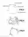 Fig. 04 - APPARATUS, METHOD AND MEDIUM STORING PROGRAM FOR RECONSTRUCTING INTRA-TUBULAR-STRUCTURE IMAGE