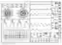 Fig. 01 - ECG data display method for rapid detection of myocardial ischemia