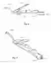 Fig. 06 - Phacoemulsification hand piece with integrated aspiration pump