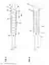 Fig. 06 - Catheter assembly with guard