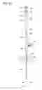 Fig. 07 - Cannula system and method for immobilizing an implanted catheter during catheter anchoring