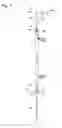 Fig. 09 - Cannula system and method for immobilizing an implanted catheter during catheter anchoring