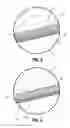 Fig. 04 - Antimicrobial luer adapter