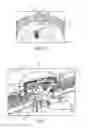 Fig. 03 - Intracranial neural interface system