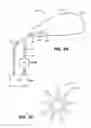 Fig. 33 - Methods and devices for treatment of migraines