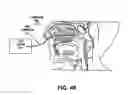 Fig. 53 - Methods and devices for treatment of migraines