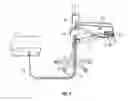 Fig. 04 - CORNEAL TREATMENT SYSTEM AND METHOD
