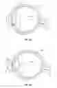 Fig. 12 - CORNEAL TREATMENT SYSTEM AND METHOD