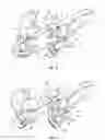 Fig. 13 - CORNEAL TREATMENT SYSTEM AND METHOD