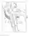 Fig. 06 - Specimen retrieval apparatus