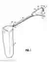 Fig. 02 - Surgical retrieval apparatus