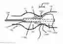 Fig. 01 - Positionable valvuloplasty catheter