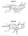 Fig. 07 - Positionable valvuloplasty catheter