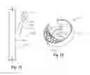 Fig. 09 - Methods and apparatus for filtering a body lumen