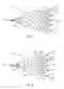 Fig. 09 - Apparatus for filtering a body lumen