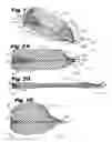Fig. 02 - Everted filter device