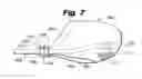 Fig. 09 - Everted filter device