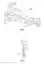 Fig. 02 - Blade deployment mechanisms for surgical forceps