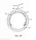 Fig. 69 - Method for vessel access closure