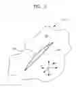 Fig. 02 - Mechanical method and apparatus for sequential tissue fastening