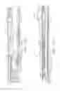 Fig. 124 - Staple cartridge comprising a releasable portion