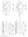 Fig. 201 - Staple cartridge comprising a releasable portion