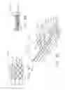 Fig. 40 - Staple cartridge comprising a releasable portion