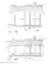 Fig. 74 - Staple cartridge comprising a tissue thickness compensator