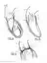 Fig. 02 - Method of manufacturing a prosthetic valve