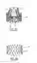 Fig. 08 - Method of manufacturing a prosthetic valve
