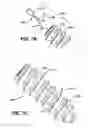 Fig. 07 - SUTURE ANCHOR WITH ENHANCED FIXATION